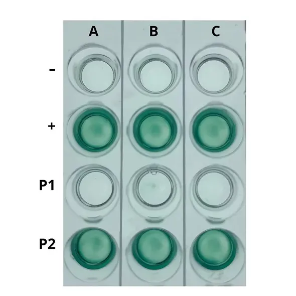 Kit AIDS I: Simulazione del Rilevamento dell'HIV mediante ELISA