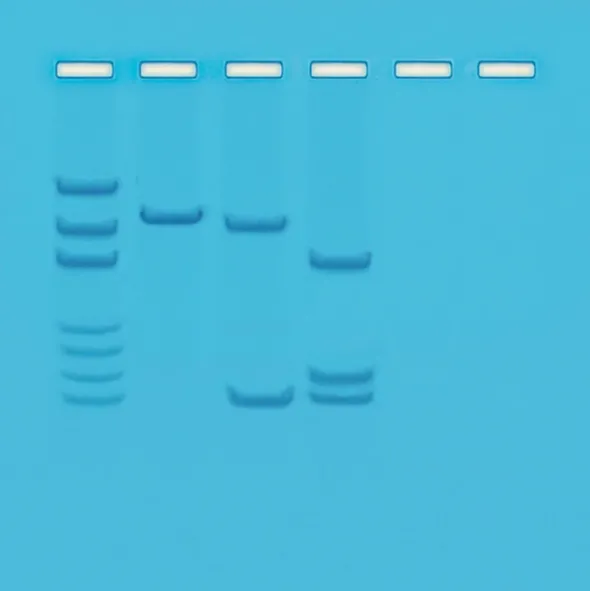 Mappatura dei siti di restrizione sul DNA plasmidico