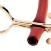 Pinza in Ottone Nichelato di Mohr 60 mm