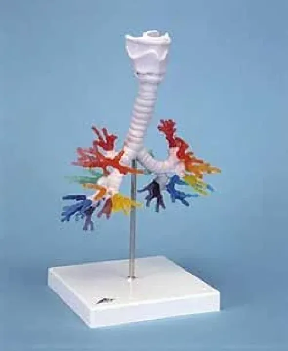 TAC di un albero bronchiale con laringe